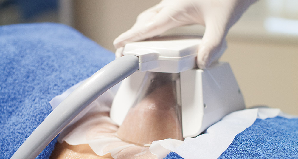How Fat Freezing and HIFU Work Together? 2 Multiple Areas in One Session HIFU and Fat Freezing Ayr