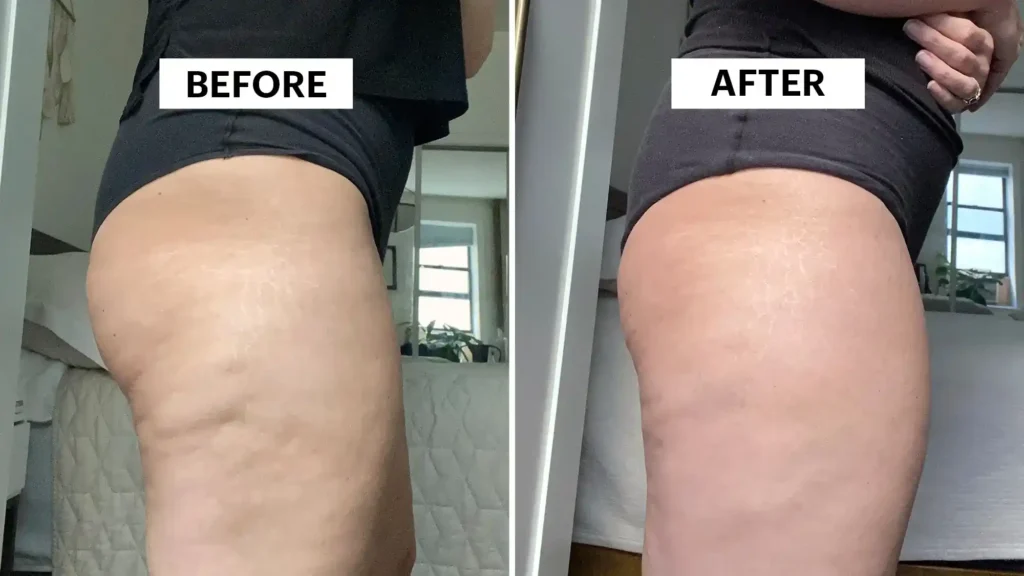 Do Toning Exercise Ayr Really Tackle Cellulite?