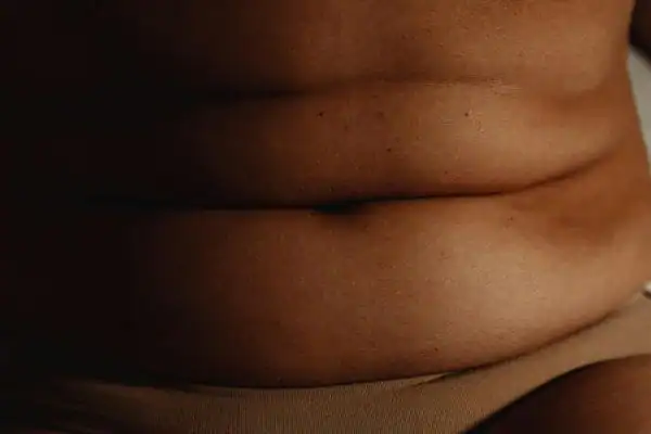The Hidden Connection: How Stress Shapes Your Fitness and Body Composition 3 image of what stress can do on the stomach area and how Lipo 360 Ayr can help to change your body shape.